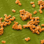A kannabisz megöli az összes ismert baktériumot, beleértve az MRSA szuperbaktériumot