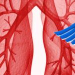 Tanulmány: A kannabinoidok kezelést nyújtanak súlyos tüdőbetegségre