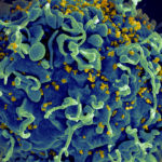 A kannabisz segíthet HIV-fertőzés esetén?
