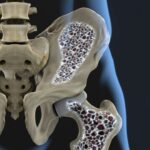 Tanulmány: A CBD gyorsítja a törött csontok gyógyulását, erősebbé teszi őket