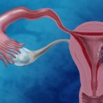 Tanulmány: A CBD segíthet az endometriális rák kezelésében