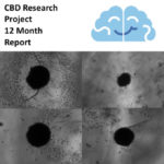 CBD és agydaganat kutatási projekt – 12. hónapi frissítés