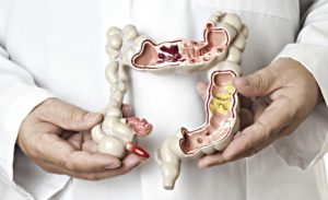 Ízületi fájdalom és bélgyulladás Crohn-betegség: a krónikus bélgyulladás - HáziPatika