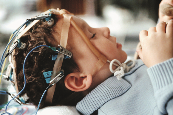 A CBD hatékonyan csökkentette az epilepsziában szenvedő gyermekek rohamait | Magyar Orvosi Kannabisz Egyesület