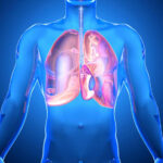 A CBD sejthalált okoz az emberi tüdőráksejtekben és a rákos őssejtekben
