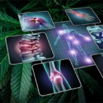 Betegek jelentik: A kannabisz hatékonyan kezeli az izom-csontrendszeri fájdalmakat